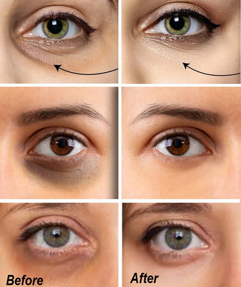 Eye corrector serum