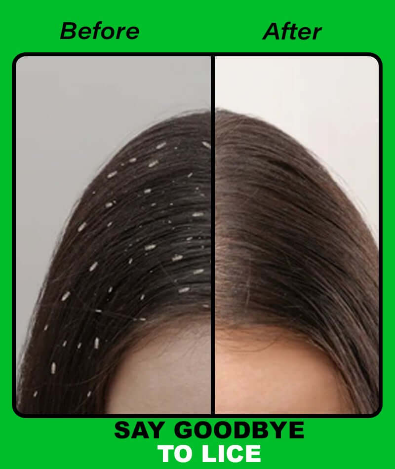 Anti Lice Shampoo
