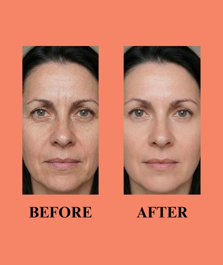 Vitamin C Cream