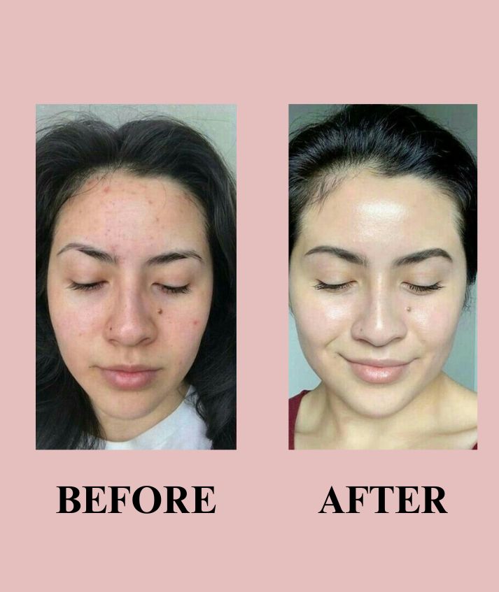 ROSE PETAL (super glow mist)