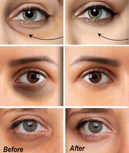 Eye corrector serum