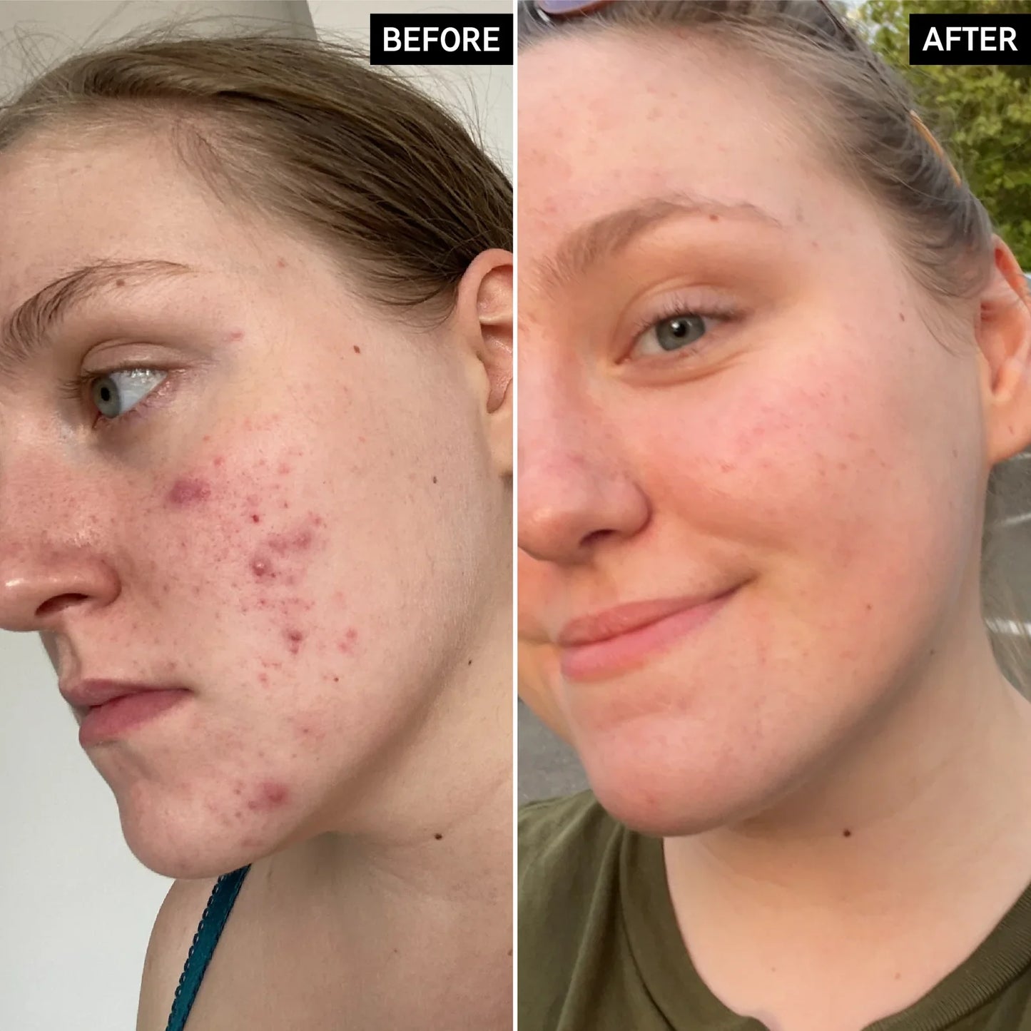 The Ordinary Glycolic Acid Duo Set