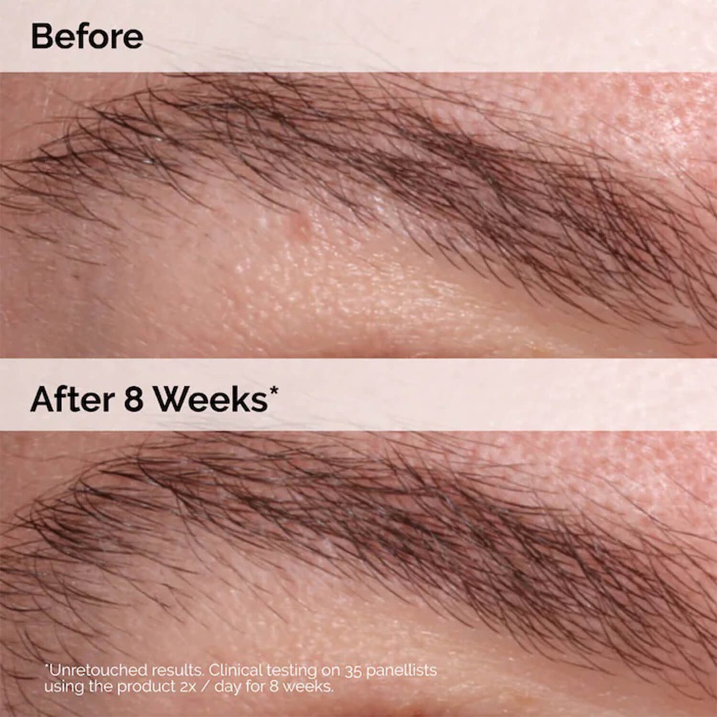 The Ordinary Multi Peptide Lash and Brow Serum
