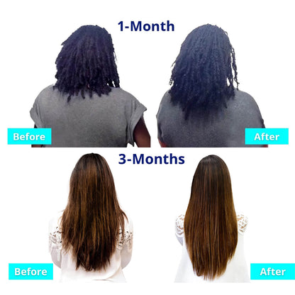 SugarBearPRO Hair Vitamin Halal Gummies