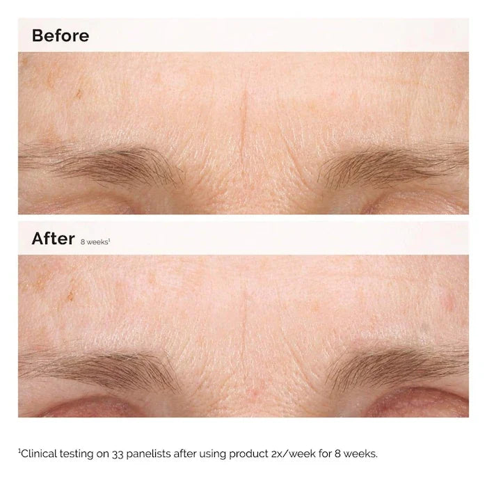 The Ordinary Retinal 0.2% Emulsion Serum